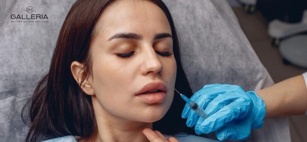best wrinkle filler for upper lip