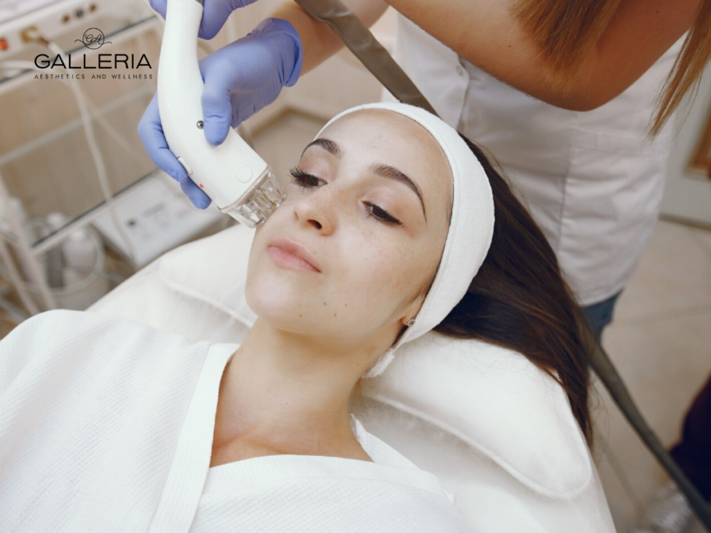 RF microneedling, Houston